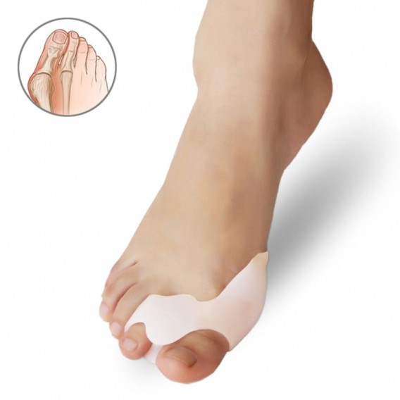 Bunion Splint Big Toe Glätteisen Korrektor Fußschmerzlinderung Hallux Valgus Korrektur Orthopädische Versorgung